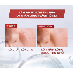 Nước Tẩy Trang L'OREAL Làm Sạch Sâu Cho Da Dầu Revitalift Crystal Purifying Micellar Water (Nắp Xám)