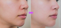 Ủ ĐẤT SÉT 7GF- DỊCH DƯỠNG TÁI TẠO BIỂU BÌ DA