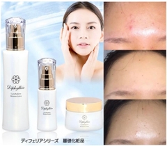 DIPHYLLEIA- CẤP ẨM, GIẢM MỤN, TÁI TẠO DA KHỎE MẠNH