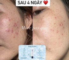 MORE PAS QUA - GEL TÁI TẠO (60g)