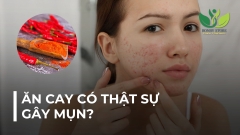 ĂN CAY CÓ THẬT SỰ GÂY MỤN?