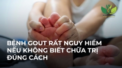 BỆNH GOUT RẤT NGUY HIỂM NẾU KHÔNG BIẾT CÁCH CHỮA TRỊ ĐÚNG CÁCH