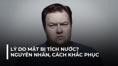 LÝ DO TẠI SAO MẶT BỊ TÍCH NƯỚC?