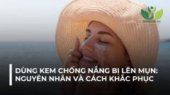 DÙNG KEM CHỐNG NẮNG BỊ LÊN MỤN: NGUYÊN NHÂN VÀ CÁCH KHẮC PHỤC
