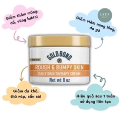 [GOLDBOND] Kem Dưỡng Da Gold Bond Ultimate Rough & Bumpy Skin 226g