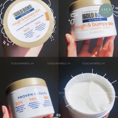 [GOLDBOND] Kem Dưỡng Da Gold Bond Ultimate Rough & Bumpy Skin 226g