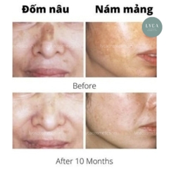 [BELLA AURORA] Serum Dưỡng Trắng Da Bella Aurora Pigment Defense Intensive Dark Spot Solution 30ml