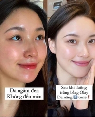 Kem Dưỡng Ban Ngày Olay Total Effects 7 In One Day Moisturiser Nourish & Hydrate 50ml