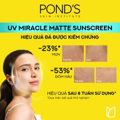 Kem chống nắng phổ rộng Pond's UV Miracle SPF 50+ PA++++ Tuýp 50G