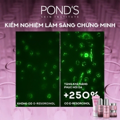 Serum Dưỡng Sáng Da Đa Tầng Pond Bright Miracle Ngày & Đêm Mờ Thâm Sạm Với 50X Niasorcinol - Lọ 30G (Hồng)