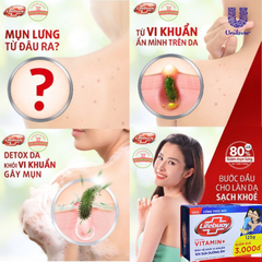 Bánh Xà Phòng Lifebuoy Xanh Sữa Dưỡng Ẩm - 125G