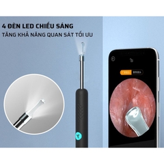 Dụng cụ lấy ráy tai tích hợp camera Bebird R1