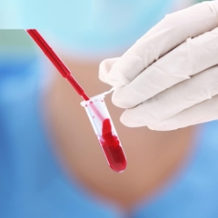 Ống ly tâm-Ống Eppendorf (Microcentrifuge Tubes), hộp 500 chiếc, hãng Biologix-USA