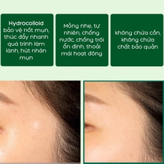 Some By Mi - Miếng Dán Trị Mụn Clear Spot Patch 18pcs-hàn