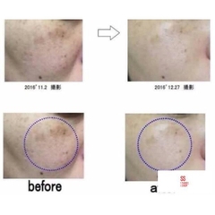 Kem trị nám Nhật H2 Hydrogen Skin Care Spot Cream 10g-nhật