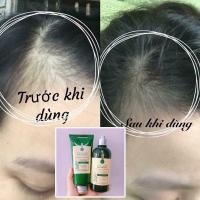 Bộ Gội Xả Gừng Tươi Weilaiya (Màu Xanh) - Mẫu cao-hồng công