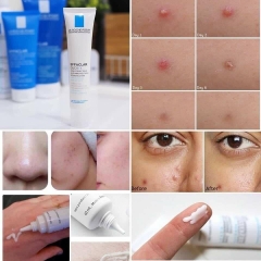 Set trị mụn La Roche Duo + 40ml tặng kèm SRM 50ml-pháp