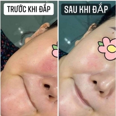 Mặt Nạ Phục Hồi Cấp Ẩm Cao Cấp Smas Peptide Silk Mask- 04miếng-nhật
