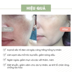 Kem Face Pháp A cosmetics dưỡng trắng da mặt 20g, kem whitening face cream