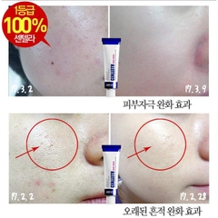 KEM TRỊ MỤN CENTELLA MEDI-PE-hàn
