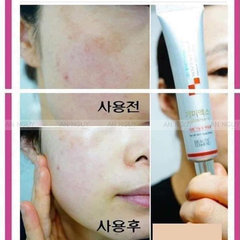 Kem nám 3D Whitening Clinic 40ml-hàn