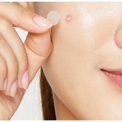 Miếng dán mụn cosrx-hàn