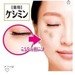 Kem trị nám Kobayashi Nhật Bản