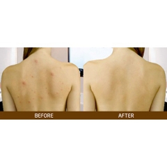 Sữa tắm A-derma giảm mụn lưng, viêm lỗ chân lông Aderma 500ml-pháp