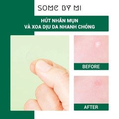 Some By Mi - Miếng Dán Trị Mụn Clear Spot Patch 18pcs-hàn