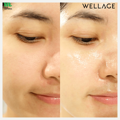 Tinh chất cấp nước WELLAGE Real Hyaluronic Blue Ampoule