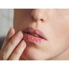 Son dưỡng môi Bioderma-pháp