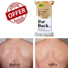 Xà Phòng trị mụn lưng For Back -Nh-nhật