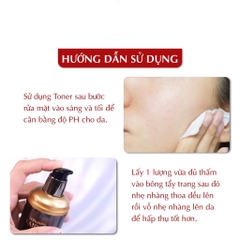 Nước Hoa Hồng trị nám Dongsung Rannce Skin 130ml-hàn
