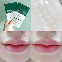 Some By Mi - Miếng Dán Trị Mụn Clear Spot Patch 18pcs-hàn