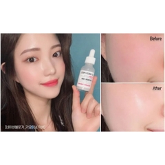 Tinh Chất Dưỡng Da Medi Peel - Bio-Intense GLUTATHIONE (Màu ĐỎ)