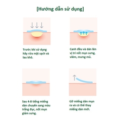 Some By Mi - Miếng Dán Trị Mụn Clear Spot Patch 18pcs-hàn