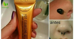 GEL LỘT MỤN KOSE _Gel 25g Nhật Bản