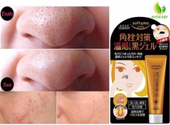 GEL LỘT MỤN KOSE _Gel 25g Nhật Bản