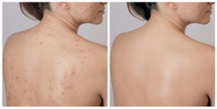 Kem dưỡng - Aloins Eaude Cream S-nhật