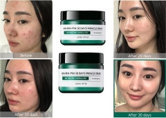 Some By Mi - Kem dưỡng AHA-hàn