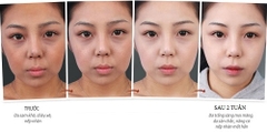 Kem trắng da 7 Day Whitening Program Glutathione 700 V-ample 50ml-hàn