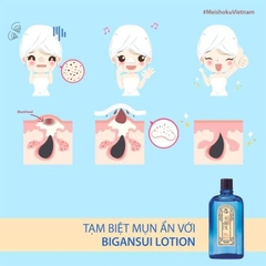 Nước Hoa Hồng Trị Mụn Meishoku - CHAI LỚN 90ML-nhật