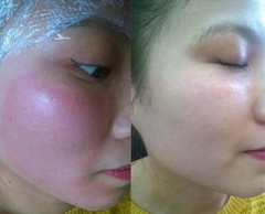 Mặt Nạ Phục Hồi Cấp Ẩm Cao Cấp Smas Peptide Silk Mask- 04miếng-nhật