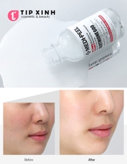 Tinh Chất Dưỡng Da Medi Peel - Bio-Intense GLUTATHIONE (Màu ĐỎ)