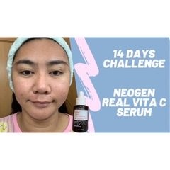 Tinh Chất Vitamin C Xoá Thâm, Làm Sáng Da Neogen