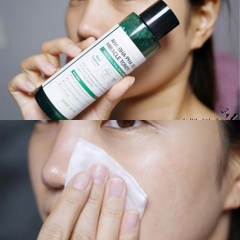 Some By Mi - Nước Hoa Hồng Mụn AHA 150ML