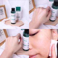 Some By Mi - Nước Hoa Hồng Mụn AHA 150ML