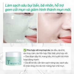 MẶT NẠ ĐẤT SÉT TRÀM TRÀ CẢI THIỆN MỤN, SẠCH SÂU, SE KHÍT LỖ CHÂN LÔNG - GUO TEA TREE MASK 50G