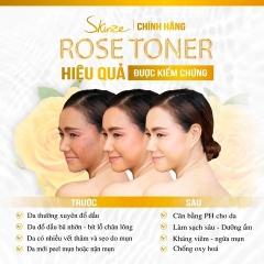 NƯỚC HOA HỒNG TONER SKINZE MOISTURIZING DÀNH CHO DA KHÔ VÀ DA THƯỜNG
