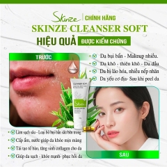 SỮA RỬA MẶT SKINZE CLEANSER SOFT CHO DA KHÔ THƯỜNG NHẠY CẢM TRÀ XANH TRÀM TRÀ KHỔ QUA B5 LÔ HỘI